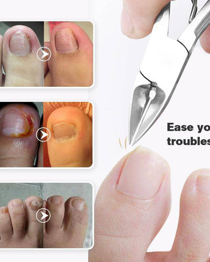 Last Day Promotion(50% OFF )Medical-grade Nail Clippers - Libiyi